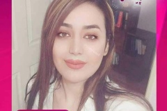 جراحی-بینی-سمنان-102