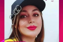 جراحی-بینی-سمنان-103