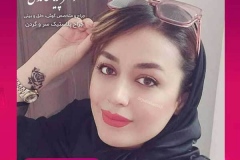 جراحی-بینی-سمنان-105