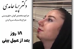 جراحی-بینی-سمنان-109