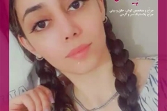 جراحی-بینی-سمنان-116