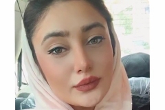 جراحی-بینی-سمنان-117