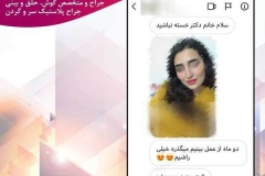 جراحی-بینی-سمنان-93
