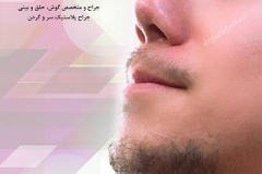 سمپل