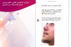 سمپل