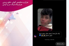 سمپل