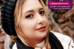 جراحی-بینی-15