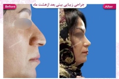 سمپل