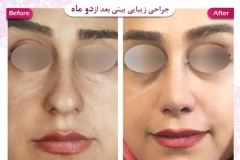 سمپل