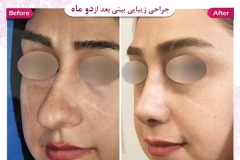 سمپل