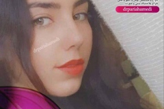 جراحی-بینی-21