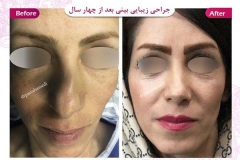 سمپل