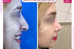 سمپل