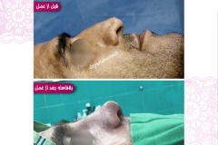 سمپل