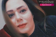 جراحی-بینی-29