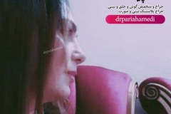 جراحی-بینی-30
