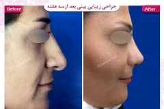 سمپل