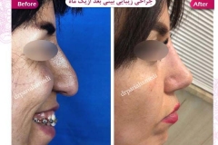 سمپل