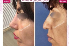 سمپل