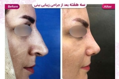 سمپل