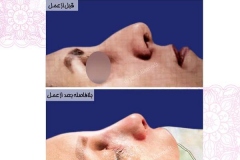 سمپل