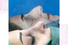 سمپل