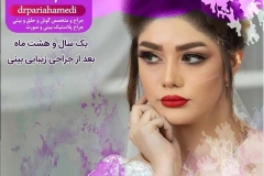 جراحی-بینی-39