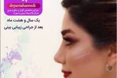جراحی-بینی-40