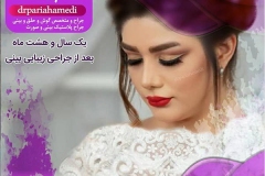جراحی-بینی-41