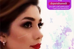 جراحی-بینی-42