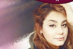 جراحی-بینی-69