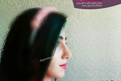 جراحی-بینی-78