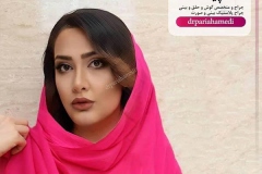 جراحی-بینی-83