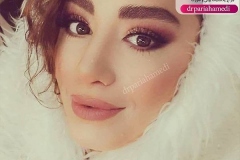 جراحی-بینی-88