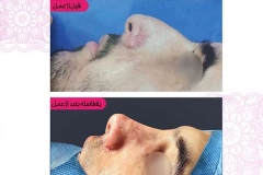 سمپل