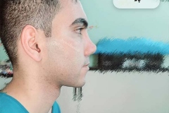 سمپل