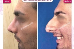 سمپل