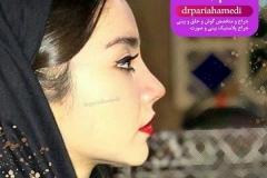 1_-بینی-35