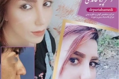 1_-بینی-37