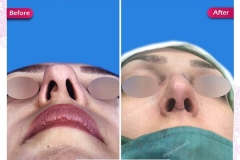 سمپل