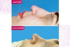 سمپل