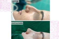سمپل