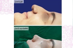 سمپل