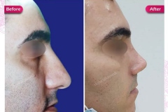 سمپل