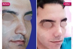 سمپل