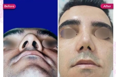 سمپل