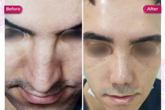 سمپل
