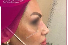 1_-بینی-92