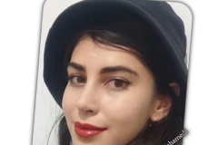 rhinoplasty-129
