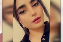 rhinoplasty-136